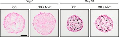 Biofabrication of prevascularized spheroids for bone tissue engineering by fusion of microvascular fragments with osteoblasts